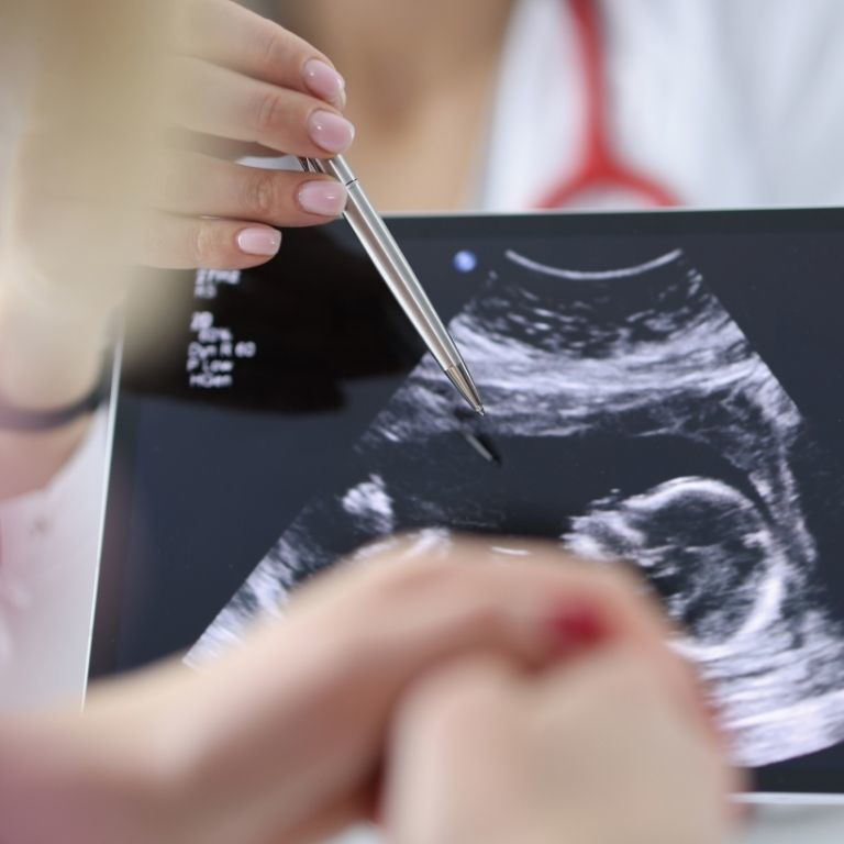 Assisted Reproduction